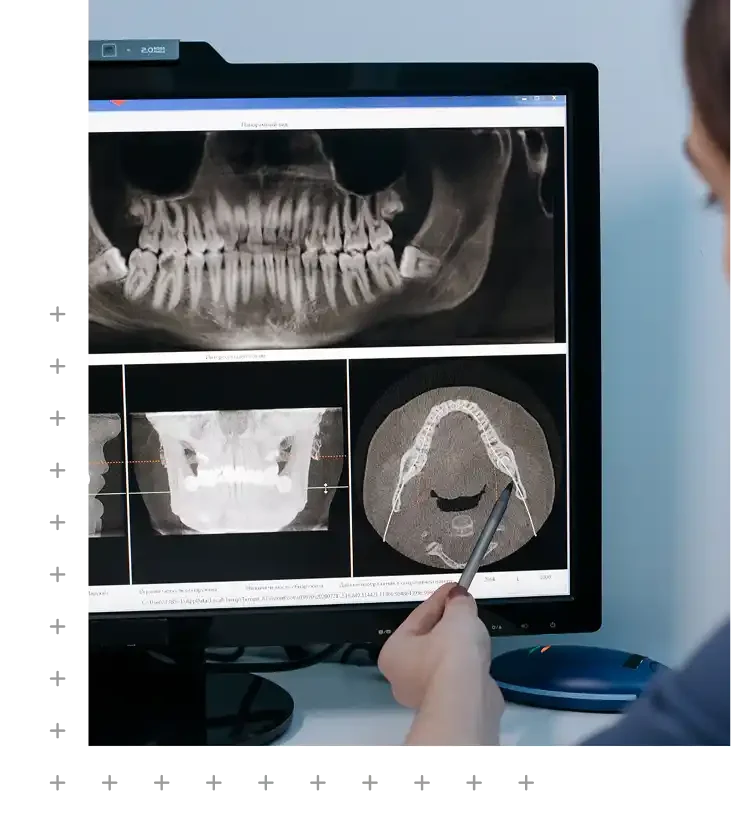 CBCT 3D Imaging in Narellan & Campbelltown in SmileSavers