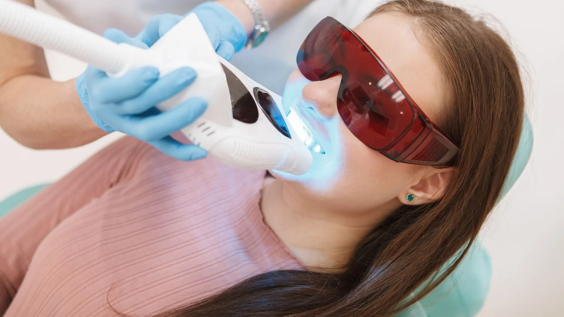 Composite bonding and teeth whitening in Narellan in SmileSavers