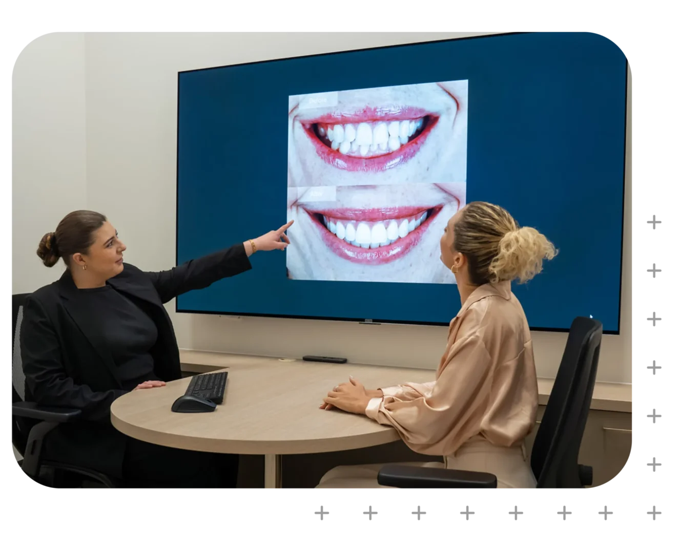 Dental Bonding in Narellan, Campbelltown