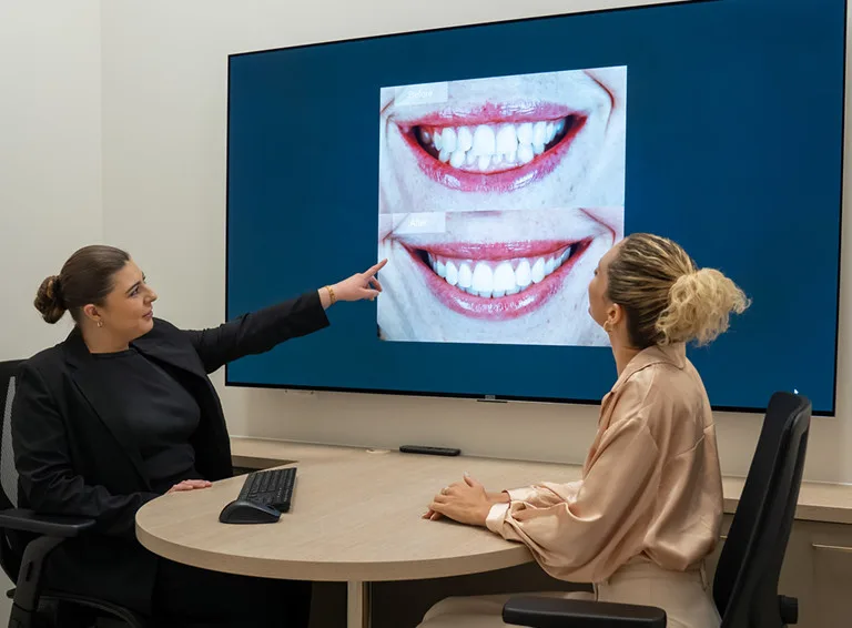 Dental Bonding in Narellan, Campbelltown