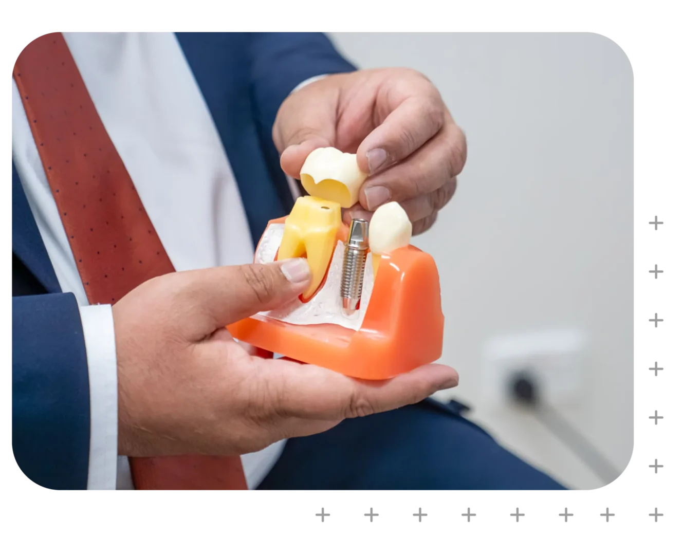 Dental Crowns & Bridges in Narellan, Campbelltown
