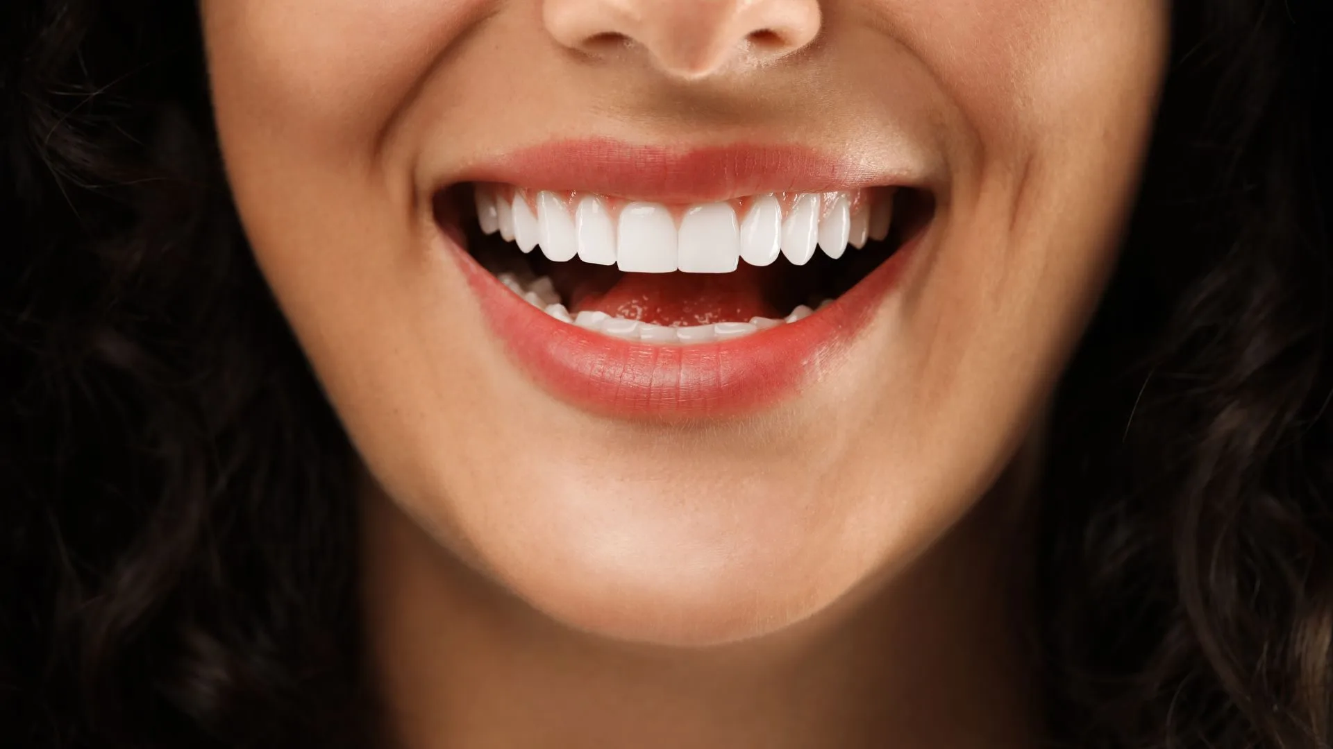 Dental Crowns and Bridge in Blairmount_in SmileSavers