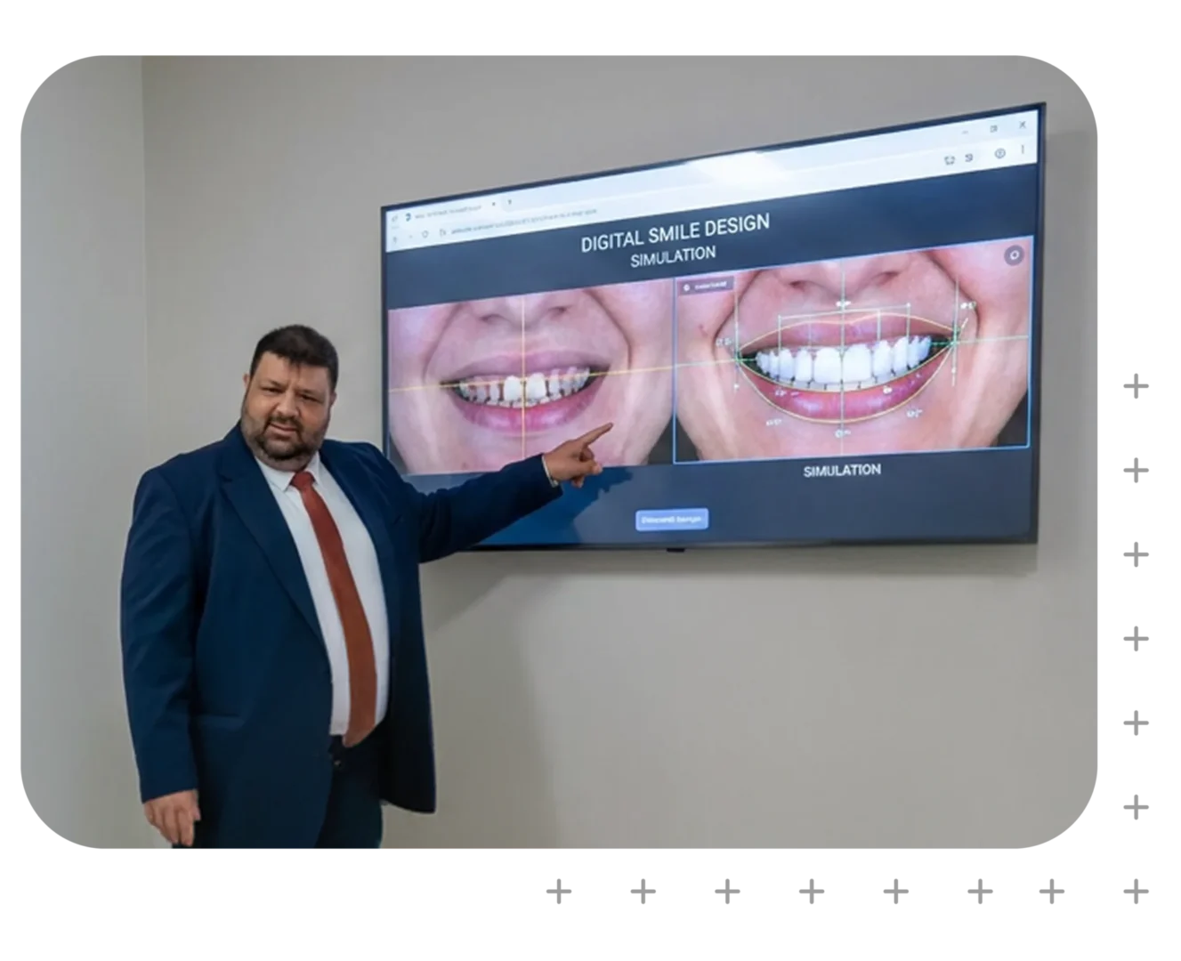 Digital Smile Design in Narellan, Campbelltown