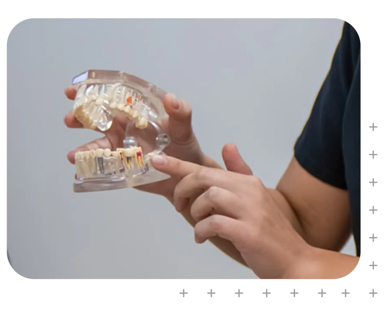 Root Canal Therapy at SmileSavers in Campbelltown, Narellan & Mount Annan